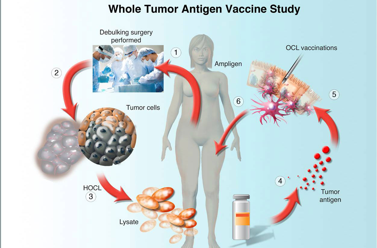 illustration of whole tumor antigent vaccine study